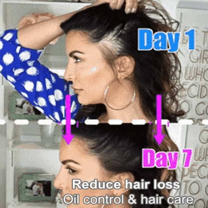 Anti-Hair Loss Ginger Shampoo - Image 4