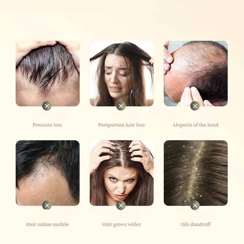Anti-Hair Loss Ginger Shampoo - Image 7