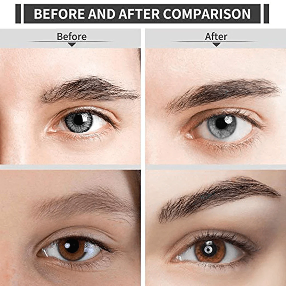 Chic Beauty Eyebrow Epilator - Image 4