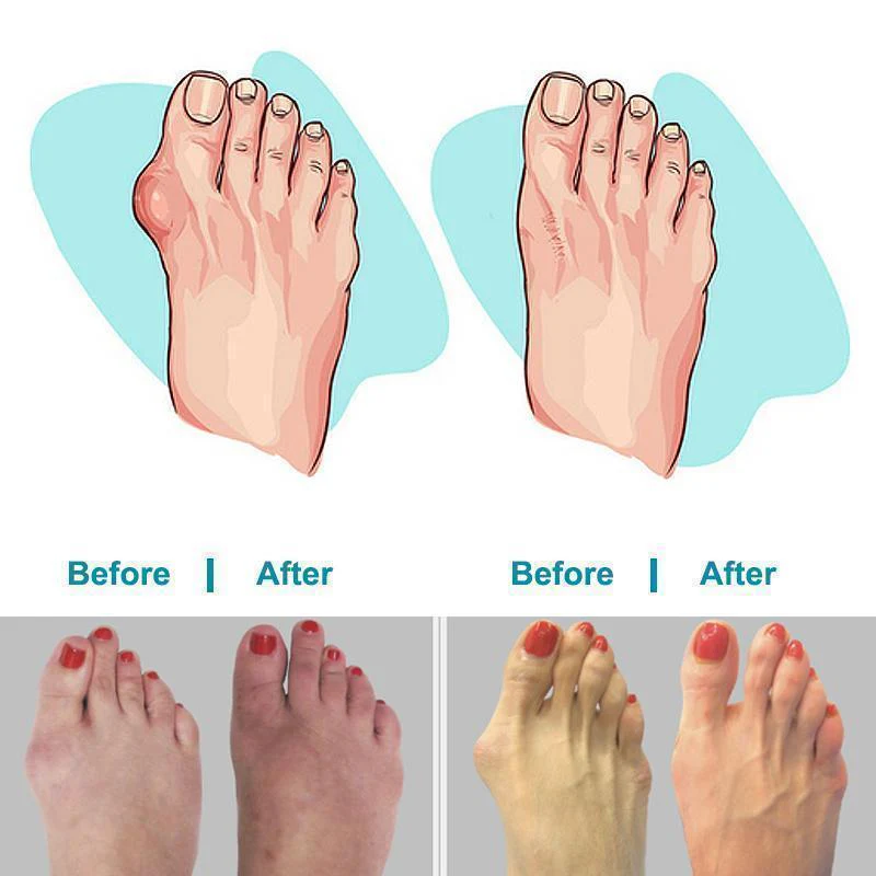 Comfortable Sandals With Thick Soles - Image 7