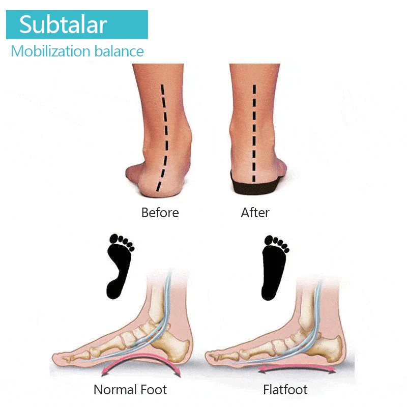 Elastic toe separator, 1 pair - Image 4