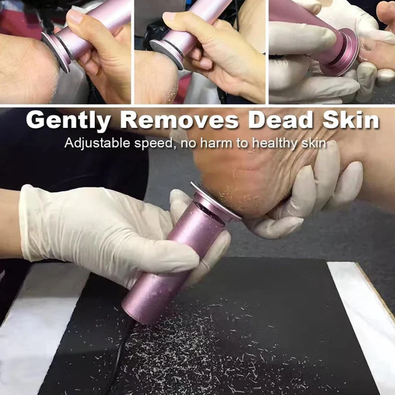 Electric Foot Care Pedicure - Image 3