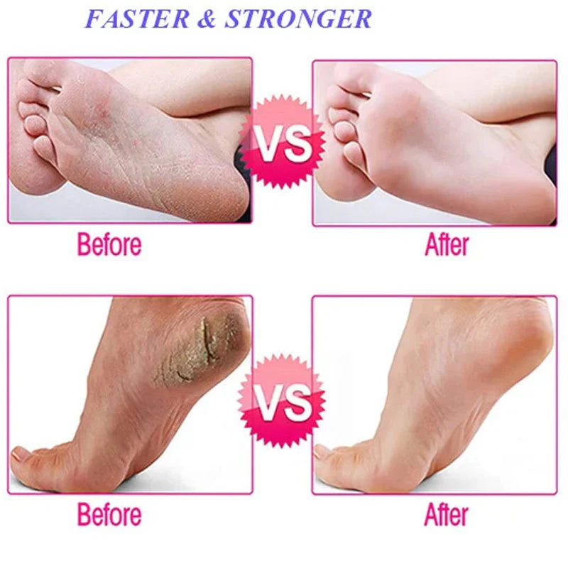 Electric Foot Care Pedicure - Image 8