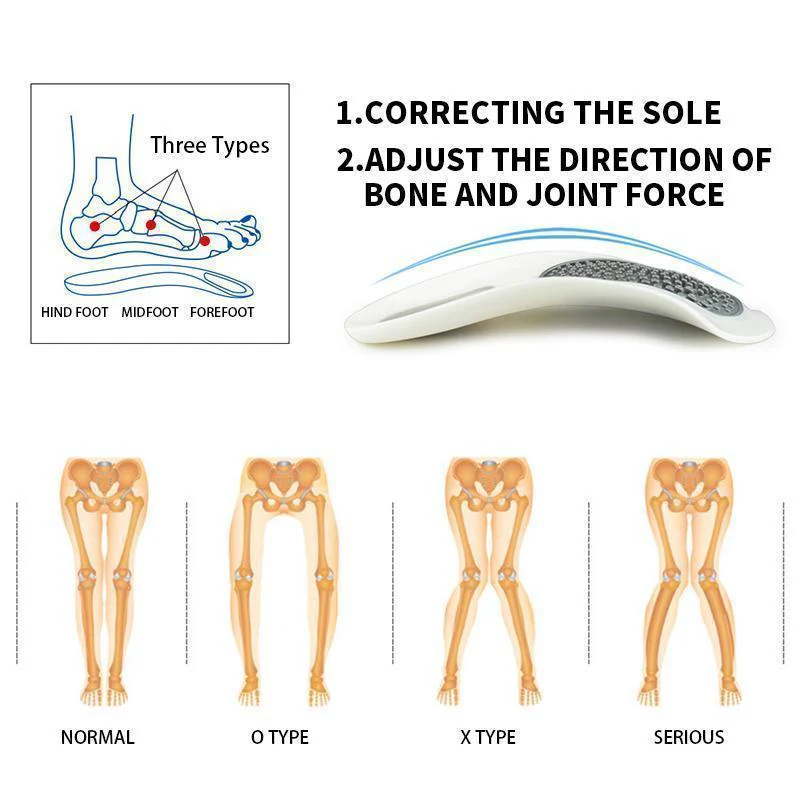 Foot Orthotics Plantar Fasciitis Arch Support Insoles - Image 4