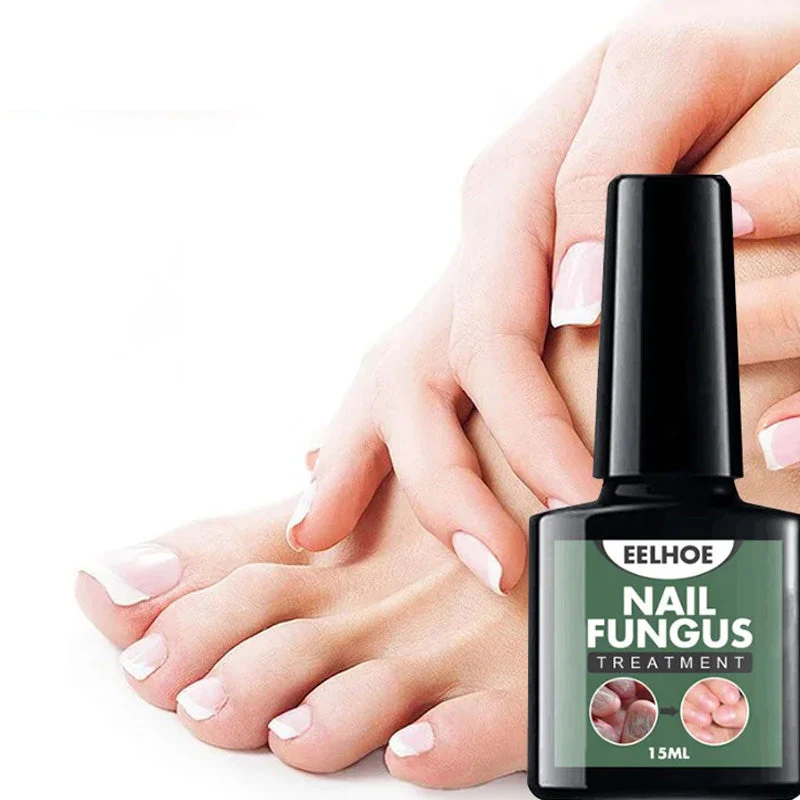 Fungal Nail Treatment - Image 5