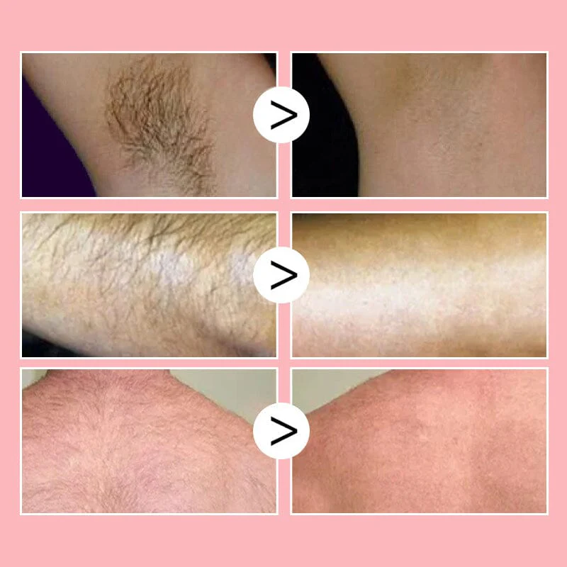 Honey Mousse Hair Removal Spray - Image 3