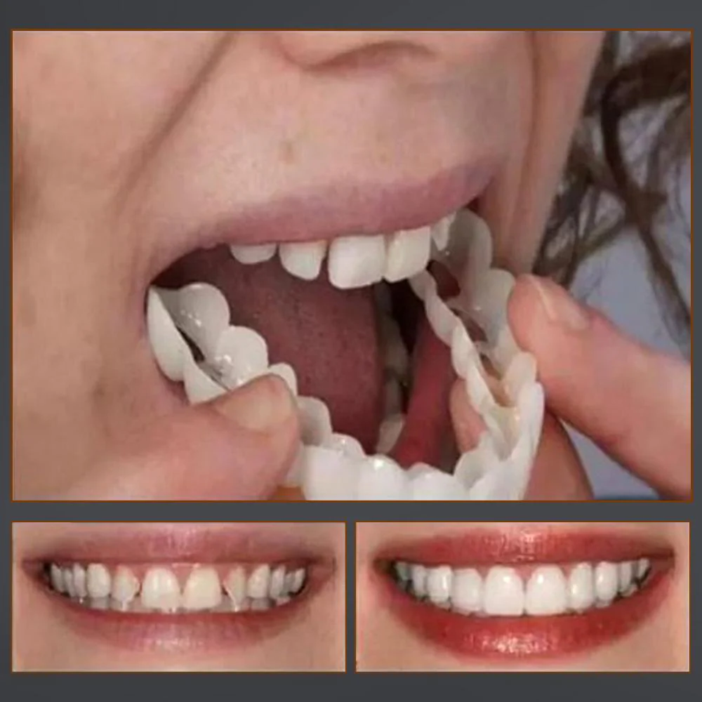 1 SET OF DIAMOND SMILE VENEERS (TOP & BOTTOM TEETH) - Image 5