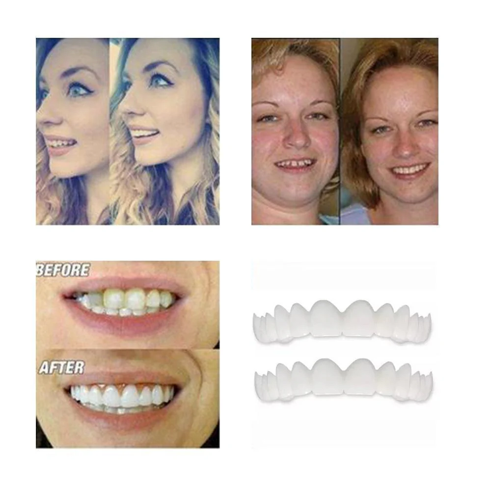 1 SET OF DIAMOND SMILE VENEERS (TOP & BOTTOM TEETH) - Image 7