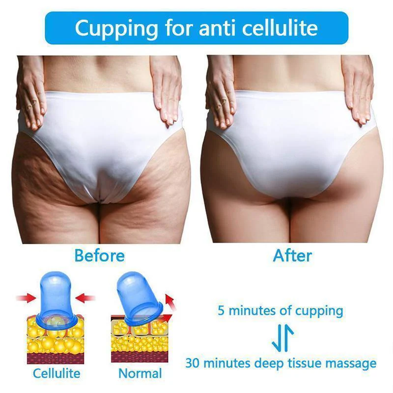 Massage Slim Cup - Image 3