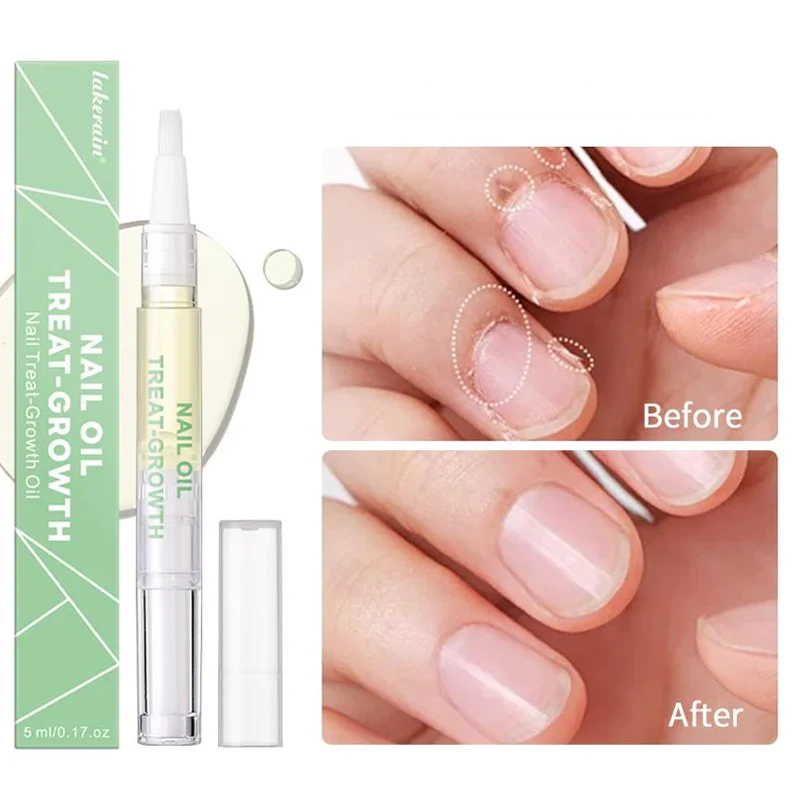 Nail Growth Oil - Image 5