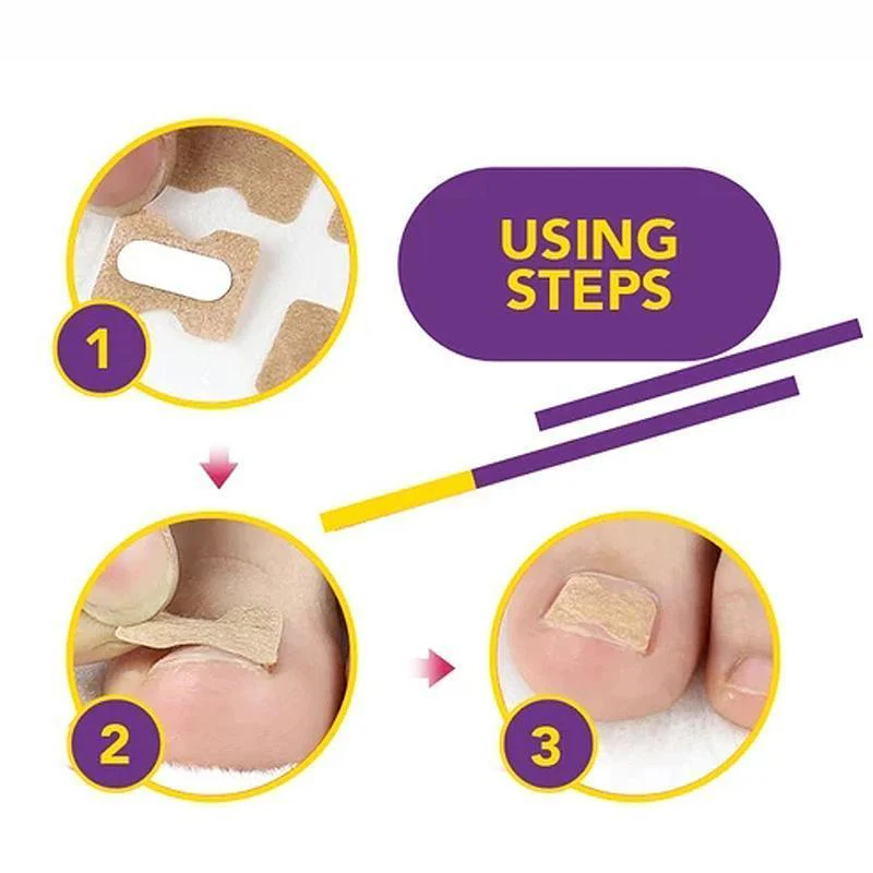 Non-Glue Toenail Patch - Image 7