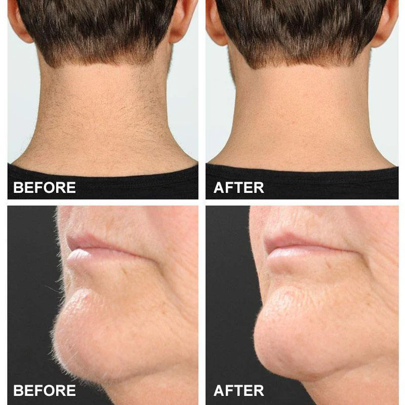 Pain-free Eyebrow Trimmer - Image 5
