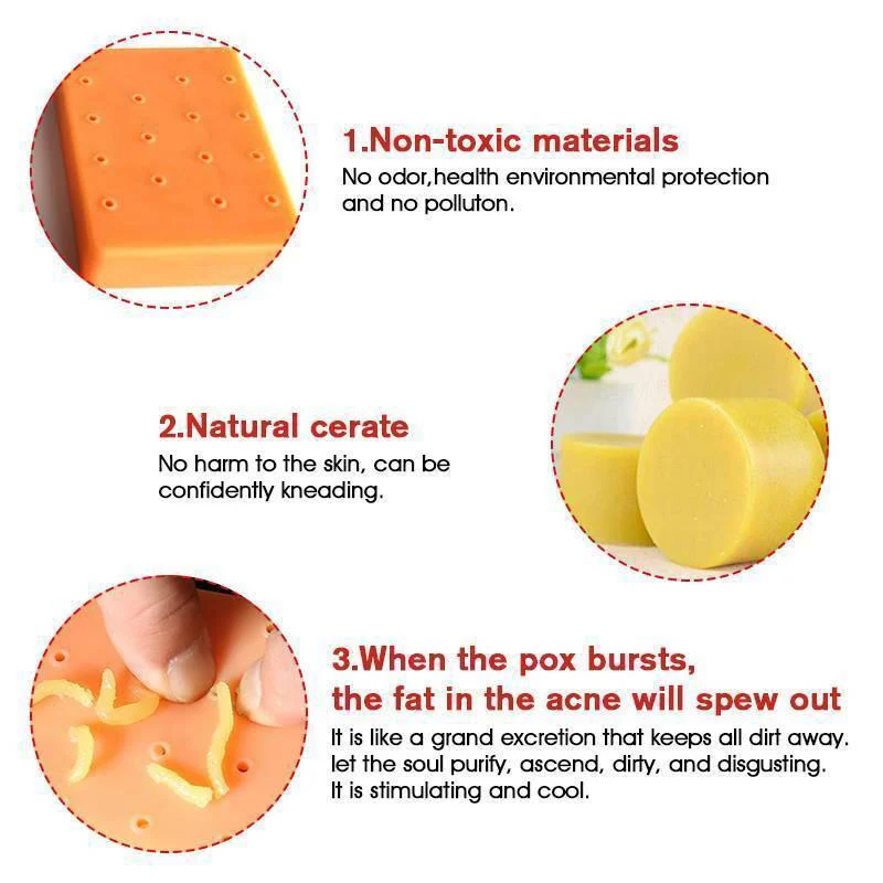 Pimple Popping Stress Relief Toy - Image 5