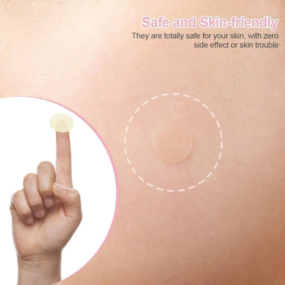 Pimples Sticker M Nexcare Waterproof & Bacteria Free Patches - Image 6