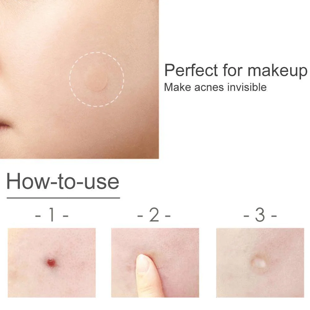 Pimples Sticker M Nexcare Waterproof & Bacteria Free Patches - Image 7