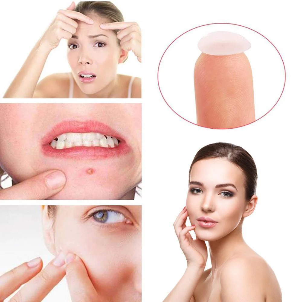 Pimples Sticker M Nexcare Waterproof & Bacteria Free Patches - Image 8