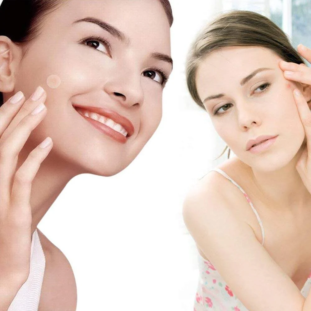 Pimples Sticker M Nexcare Waterproof & Bacteria Free Patches - Image 9