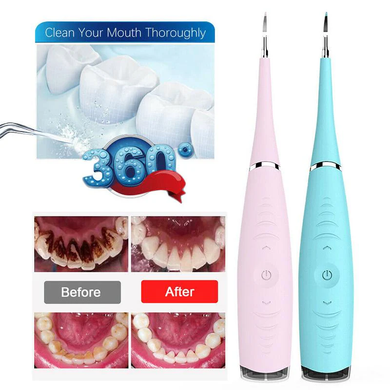 Ultrasonic Tooth Cleaner - Image 5