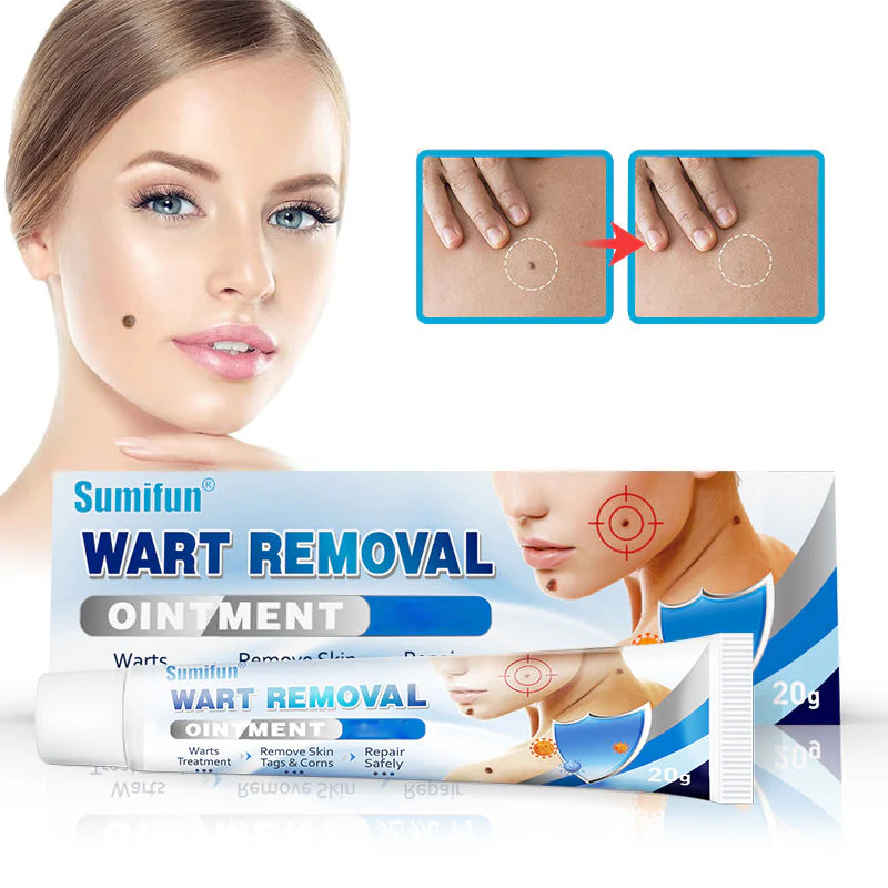 Wart Removal Ointment - Image 2