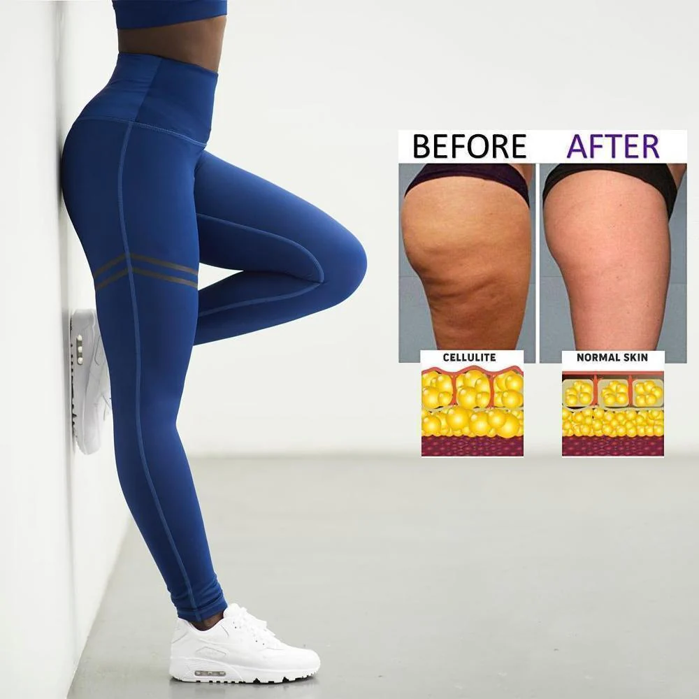 Women's Anti-cellulite Compression Leggings - Image 5